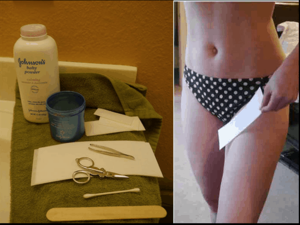 aliasgar rampurawala recommends brazilian wax tutorial 2017 pic