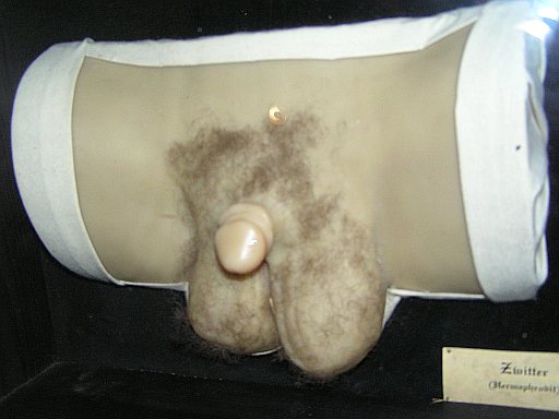david ballentyne recommends hermaphrodite photos of genitalia pic