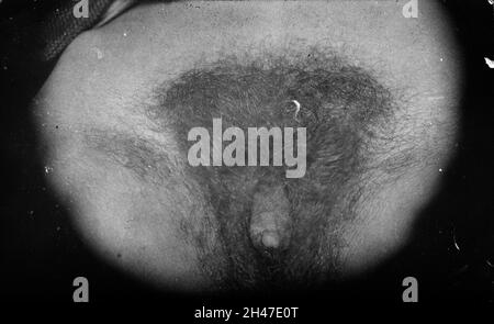 deepak abraham recommends images of a hermaphrodite pic