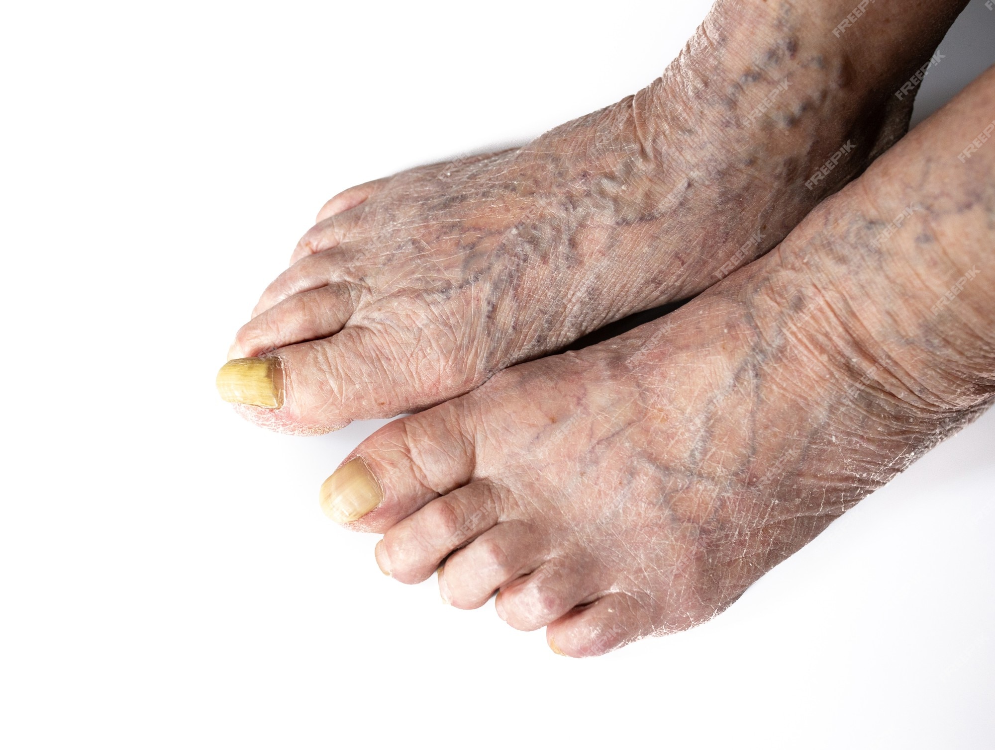 ashley nishiyama recommends older women feet pics pic