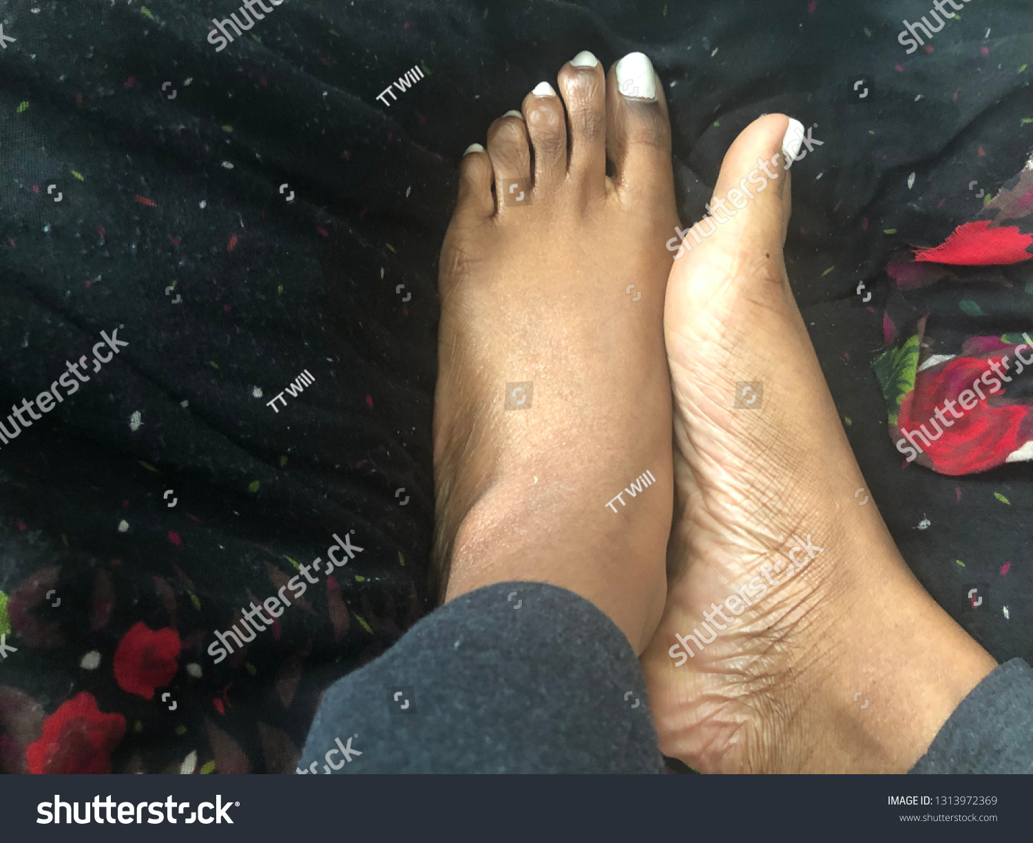 derrick cade recommends Black Women Foot Fetish