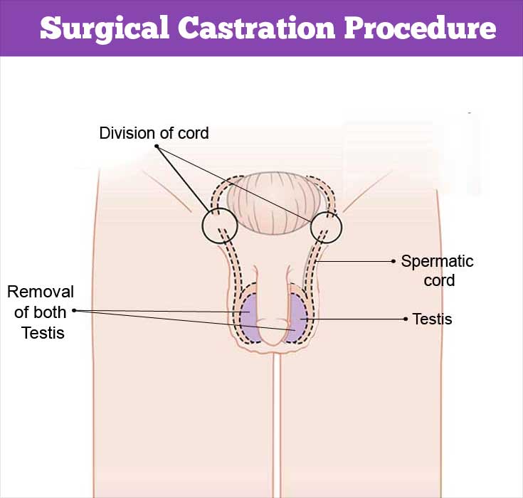 castration video human surgery