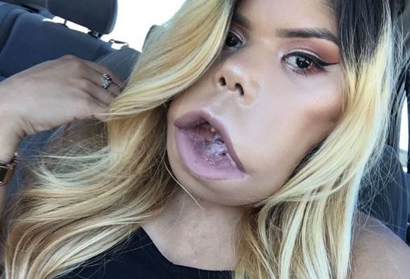 carter tyler recommends youtuber with big lips pic