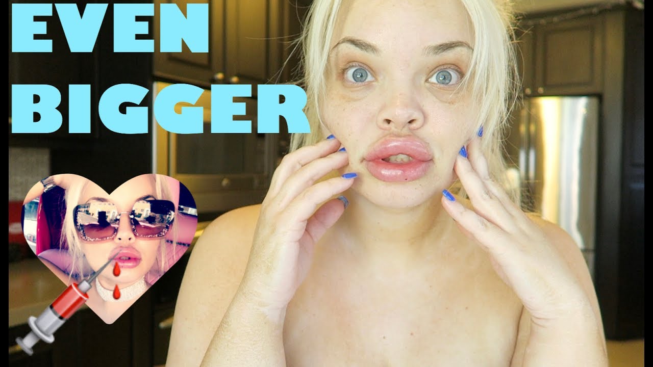 cali murray recommends Youtuber With Big Lips