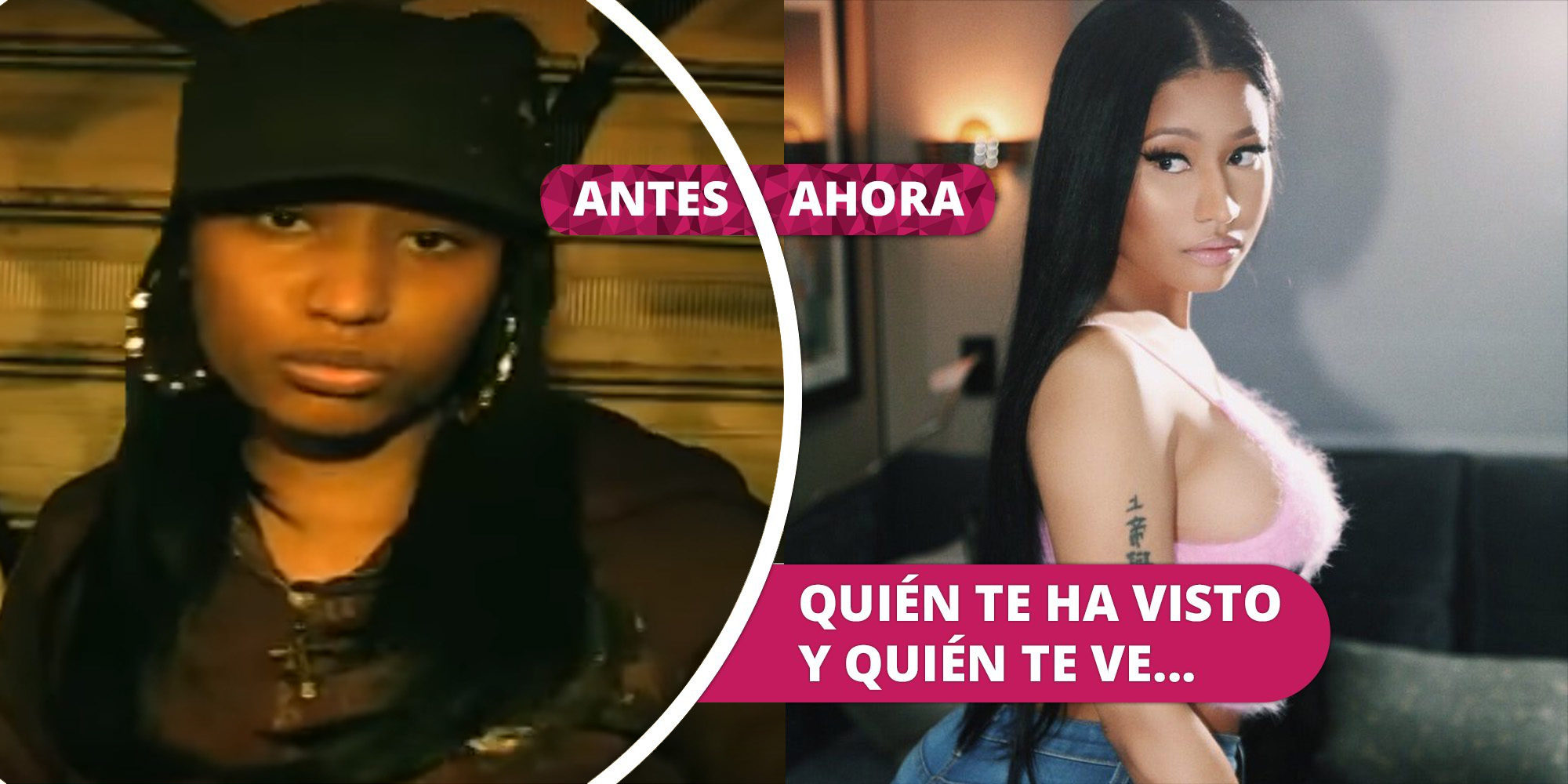 ariel godoy recommends Nicki Minaj Antes Y Despues
