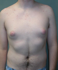 fat nipples pics