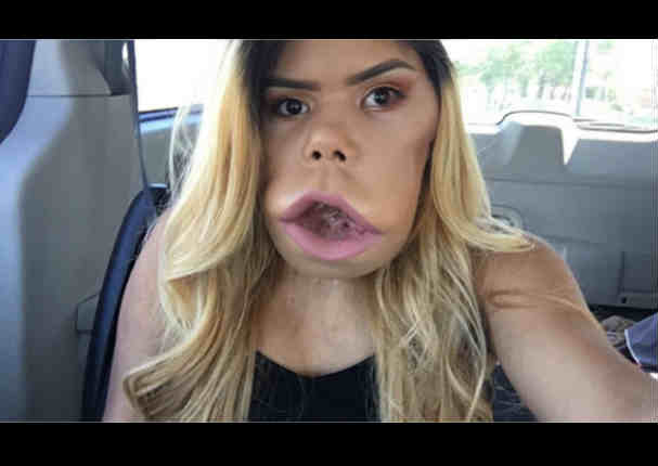 bonita barlow add youtuber with big lips photo