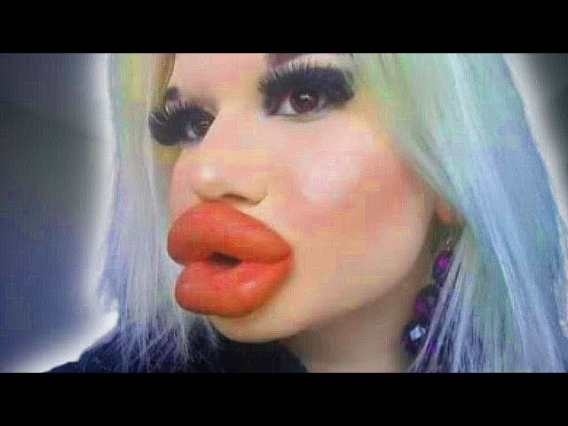 avjel tabanera recommends Youtuber With Big Lips