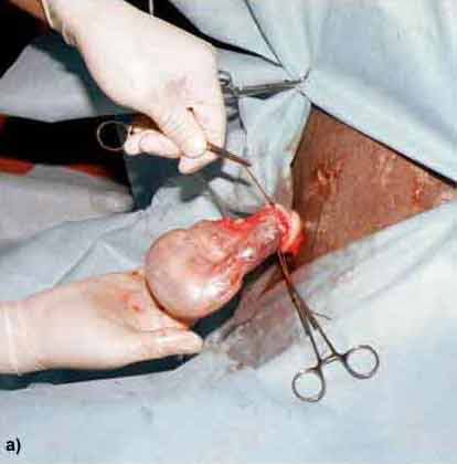 aikeh fabia recommends castration video human surgery pic