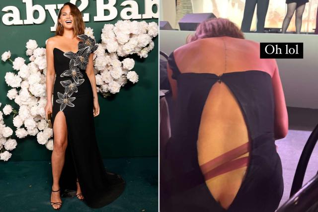 alissa quinn recommends chrissy teigen wardrobe malfunction uncensored pictures pic