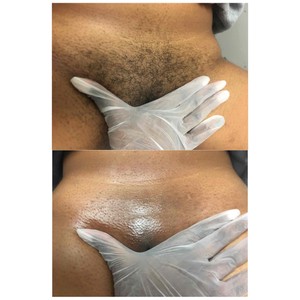 bart norman share brazilian wax pictures photos photos