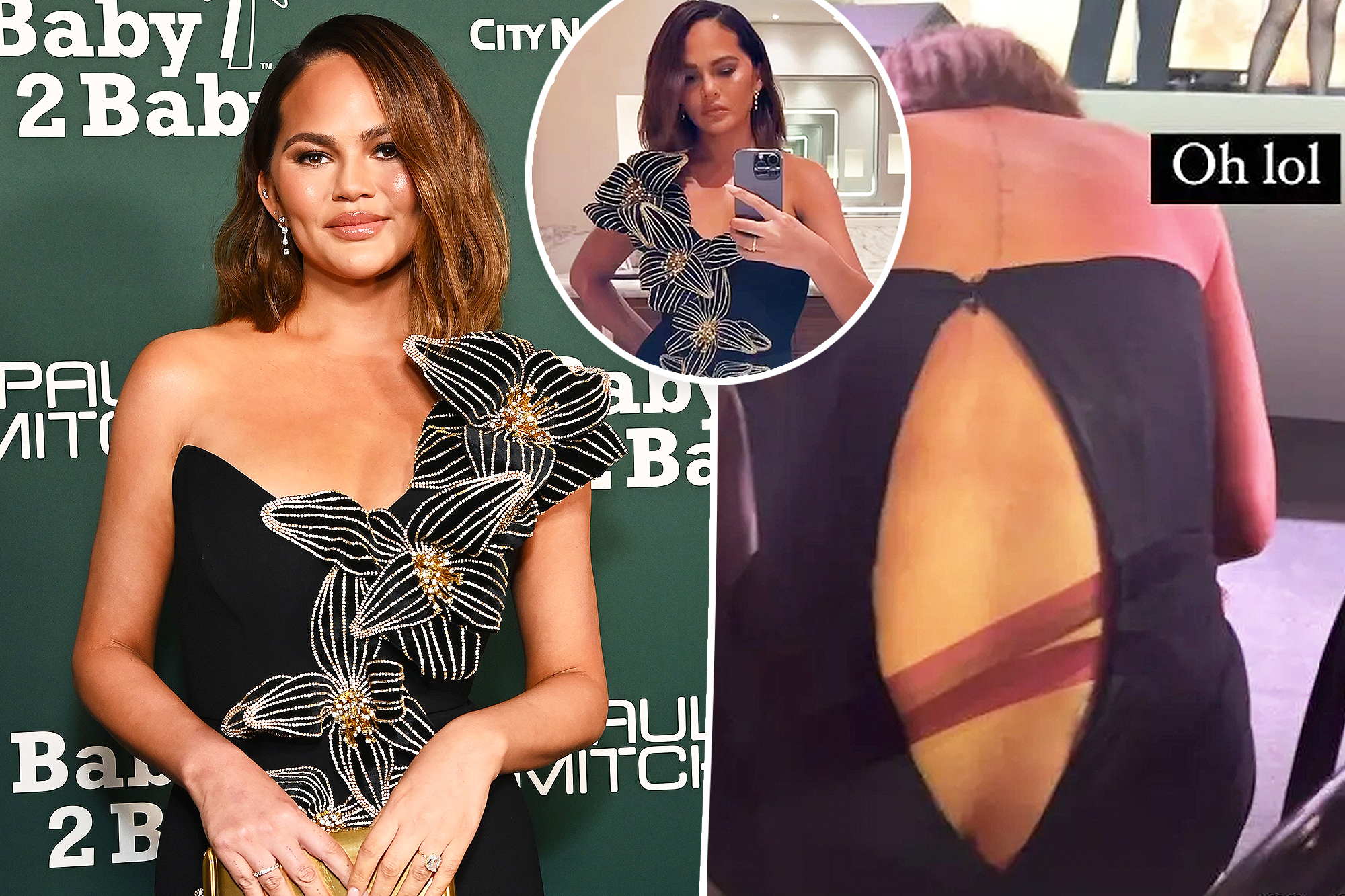 aris zhao share chrissy teigen wardrobe malfunction uncensored pictures photos