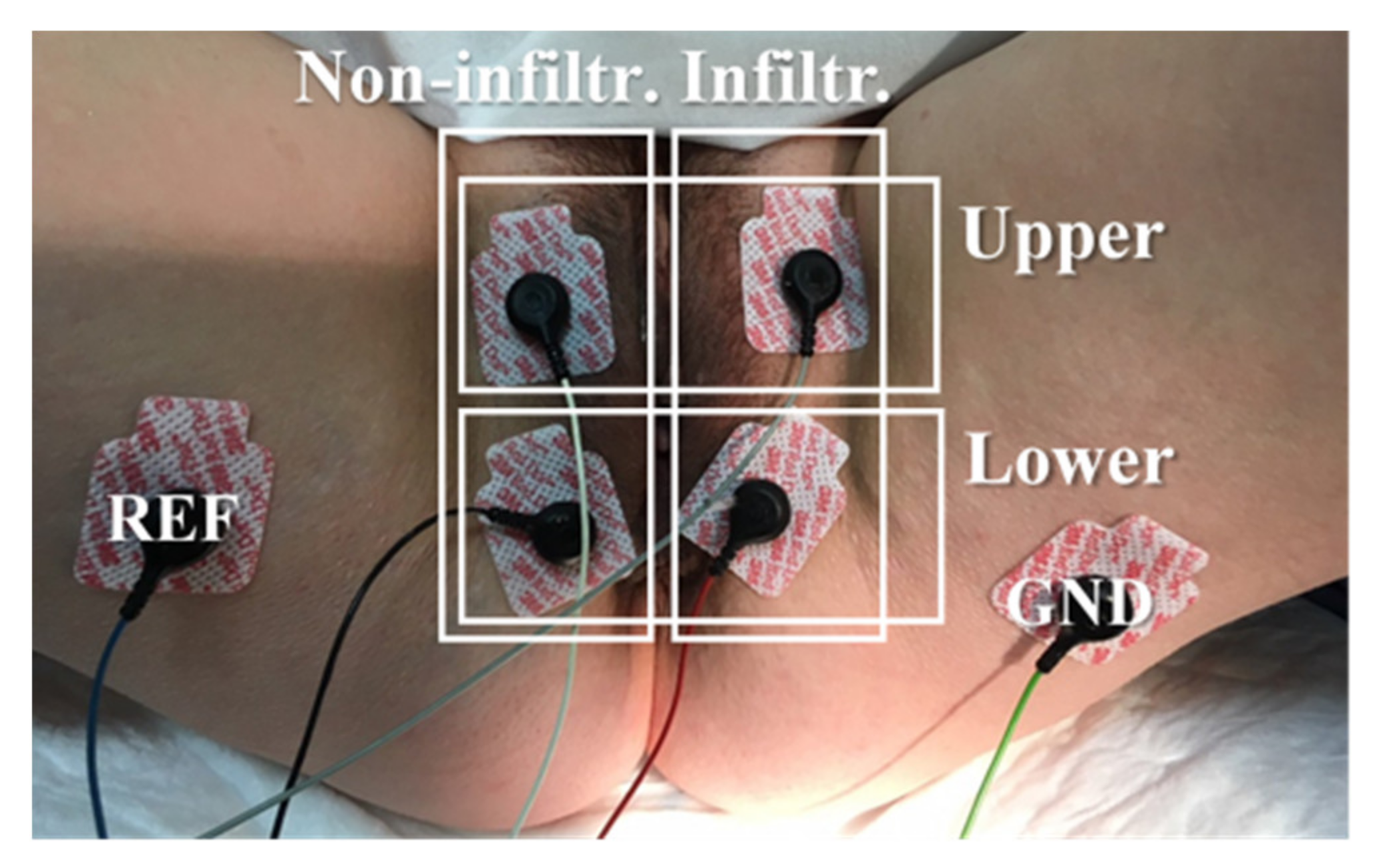 andrew sperber recommends tens unit and sex pic