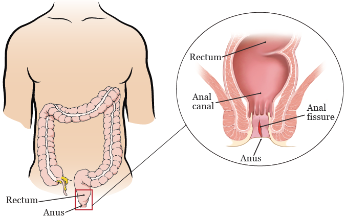 ade purnama recommends forced painful anal pic