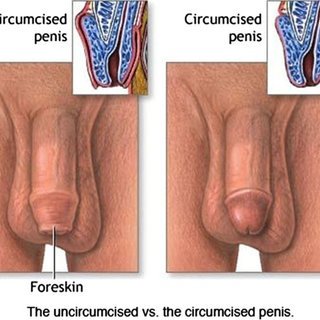 doni alexander recommends How To Masturbate Uncircumcised