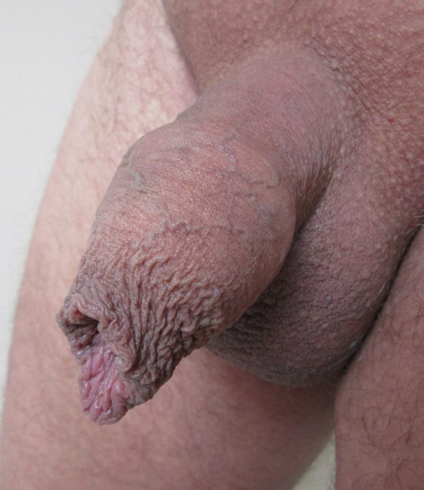 beatriz mascarenhas recommends Pictures Of Uncircumcised Cocks