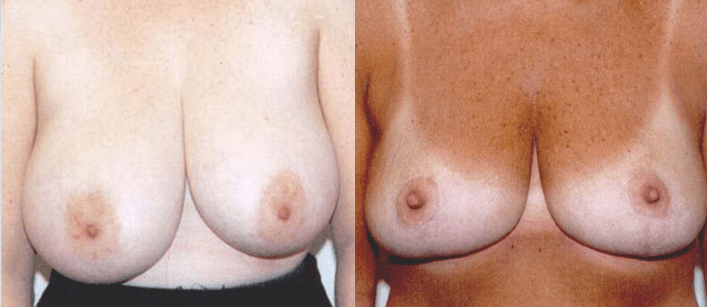 desiree sullivan recommends small nipples pics pic
