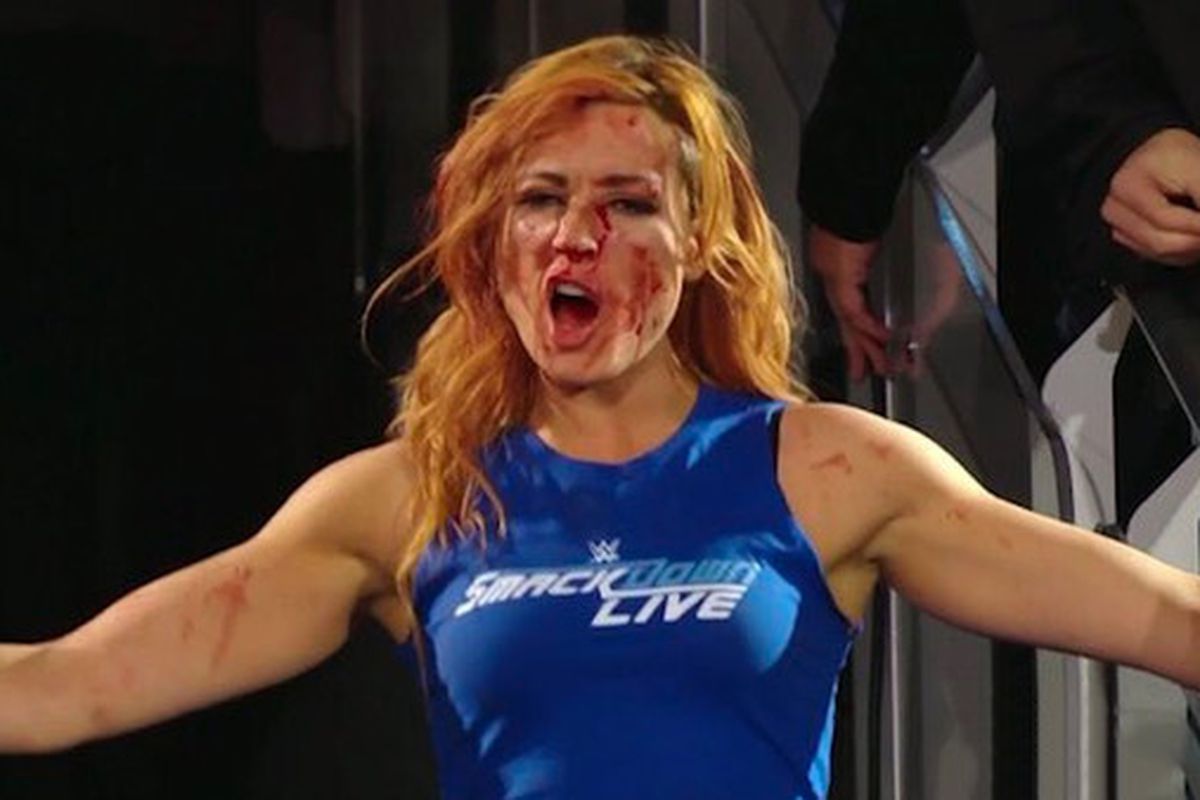 christina hoffner recommends wwe becky lynch feet pic